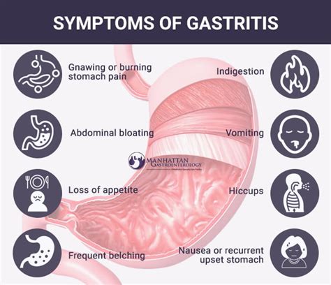 Gastritis: Symptoms & Causes .
